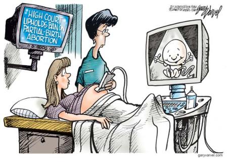 ban-on-partial-birth-abortion-varvel.jpg